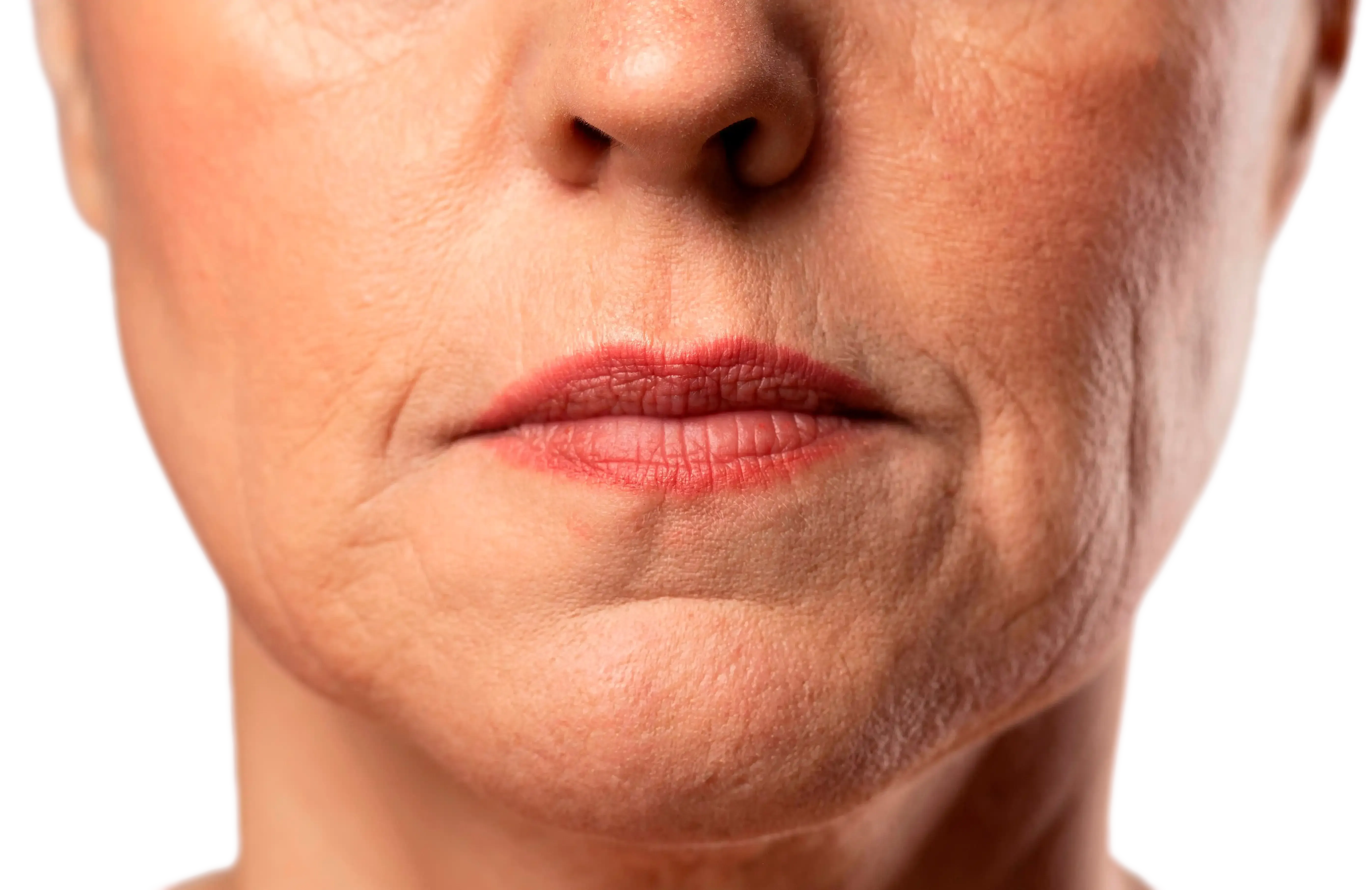 Diagram showing the lip border and lipstick bleed from vertical lip lines at Healthy Enhancements Wellington