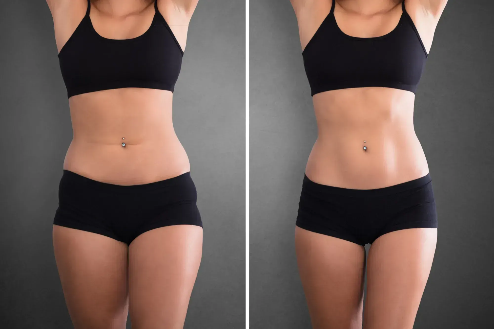 Before and after Weight Loss treatment result at Healthy Enhancements in Wellington, FL