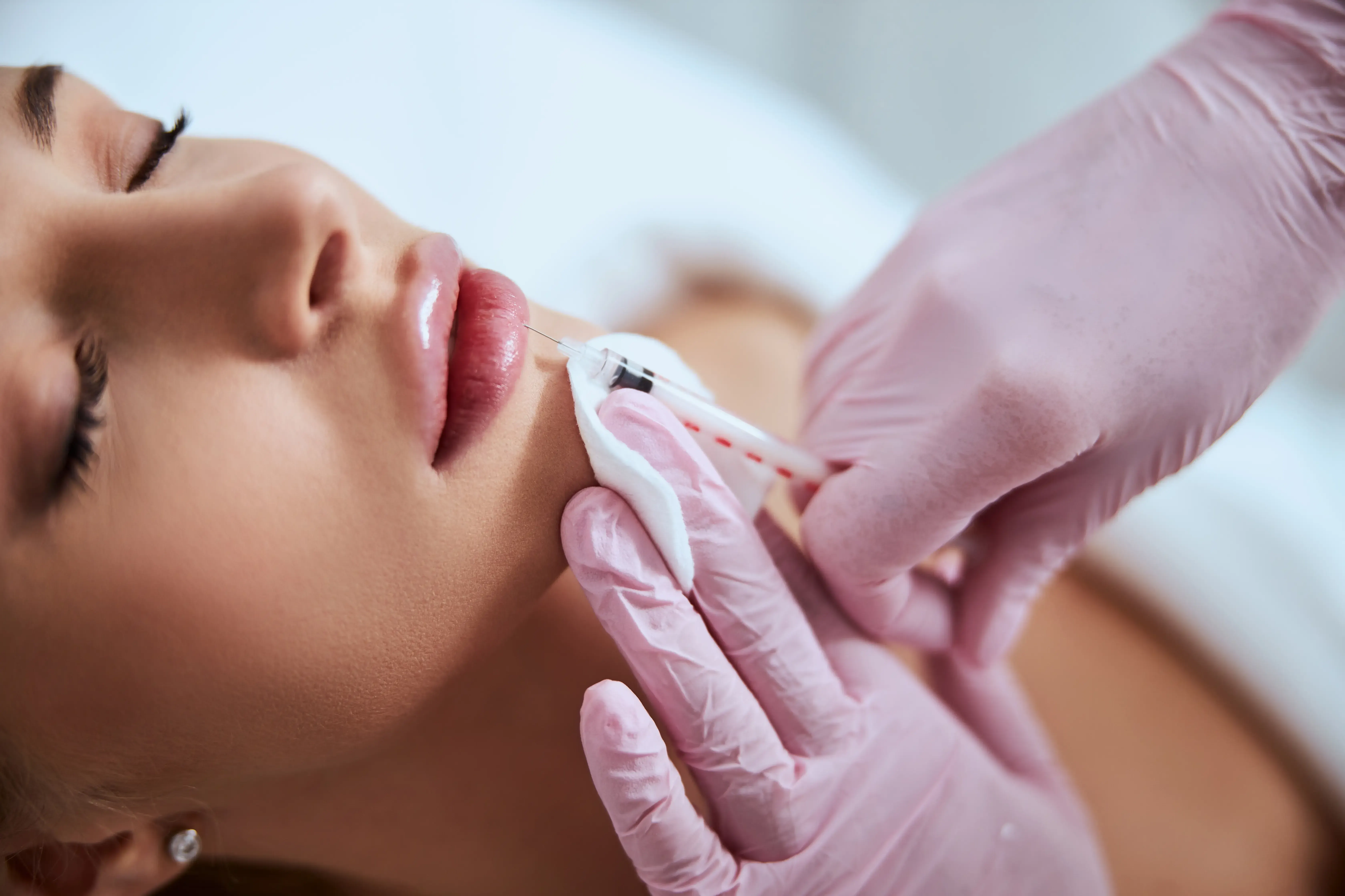 Juvederm dermal filler treatment at Healthy Enhancements in Wellington, FL