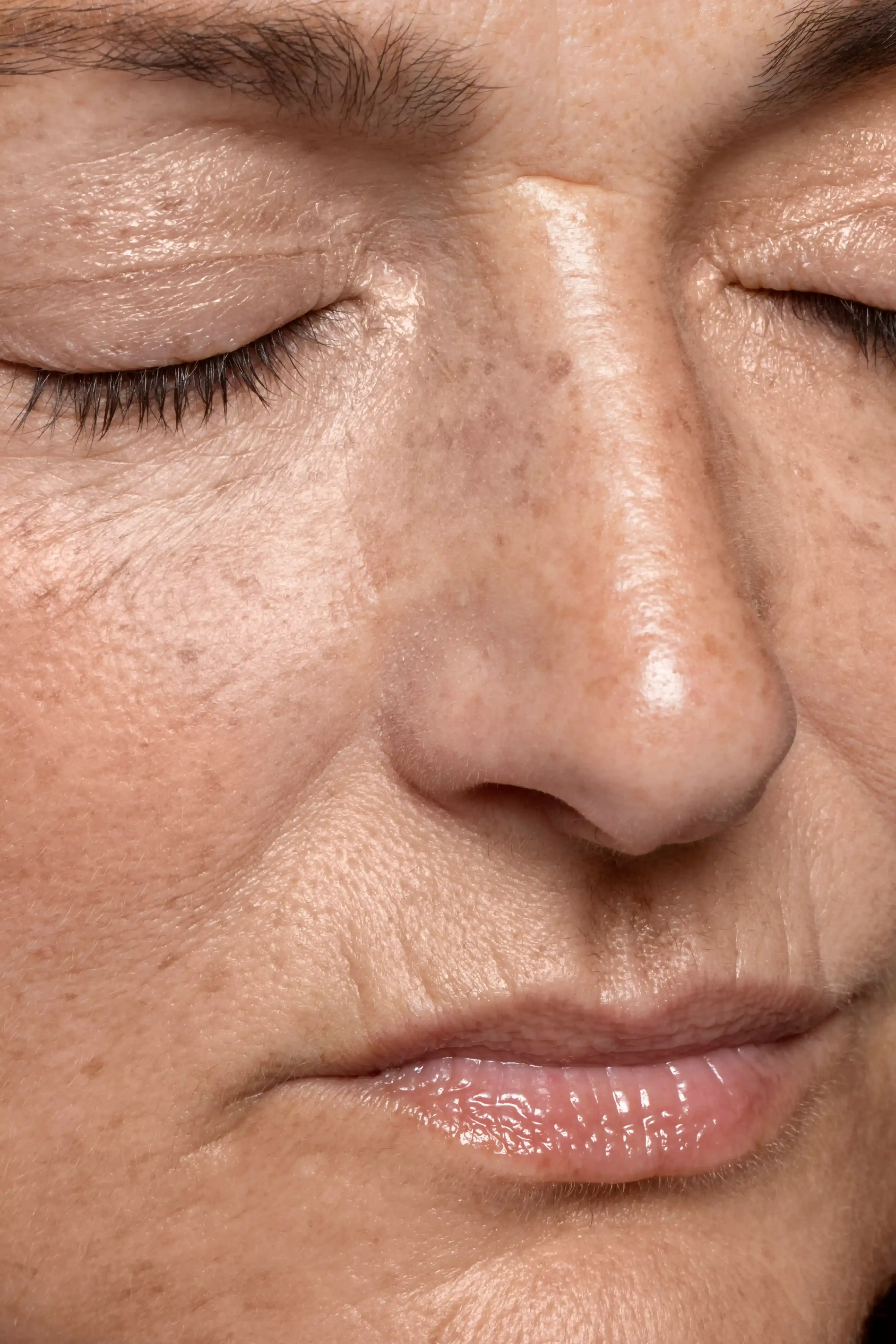 Close-up of fine vertical lip lines above the upper lip at Healthy Enhancements Wellington