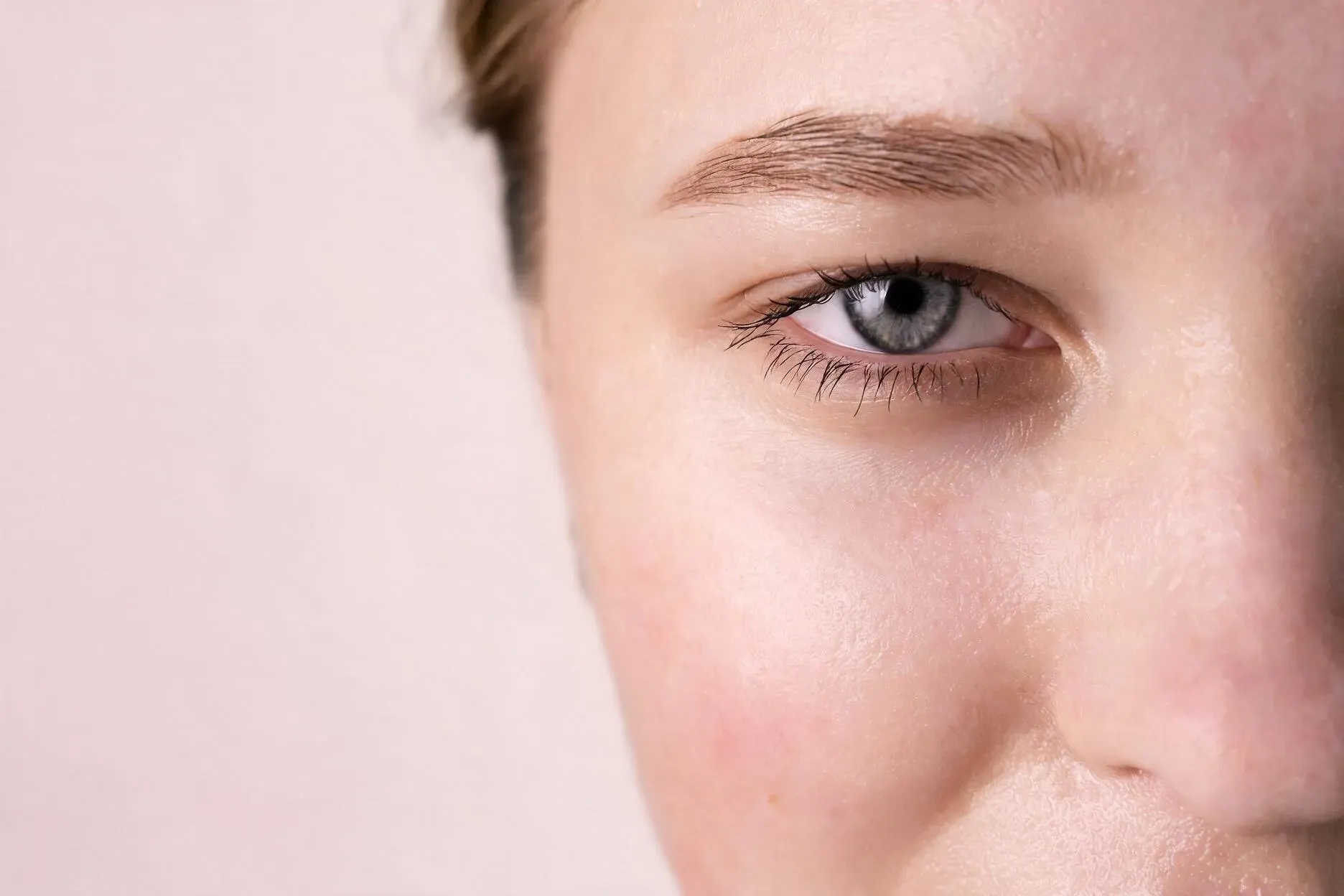 Woman with droopy upper eyelids looking in the mirror before treatment at Healthy Enhancements Wellington