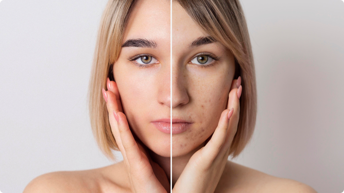Before and after facial treatment results